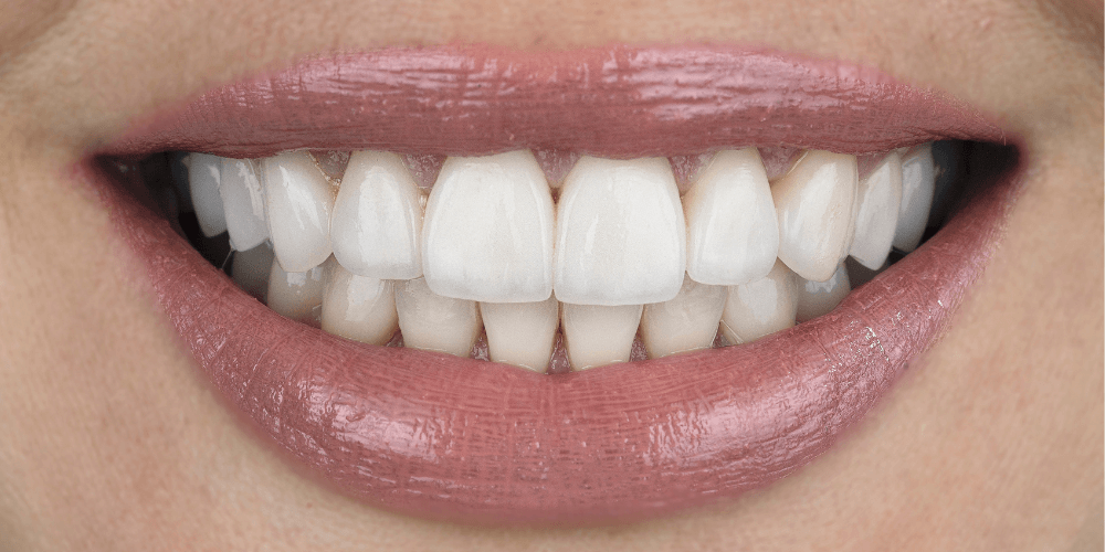 Clinica dental en Puerta de Toledo