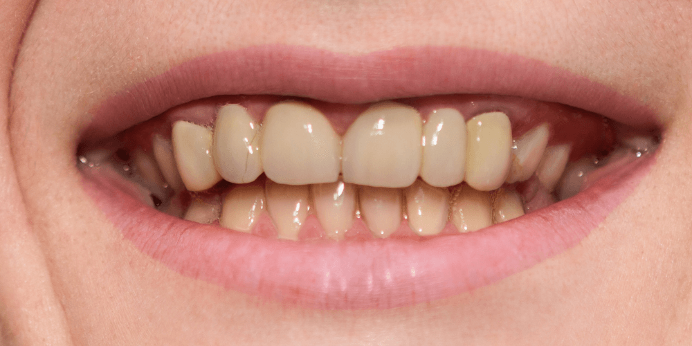 Clínica dental en Puerta de Toledo