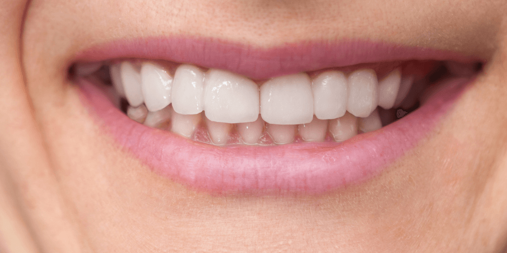 Clinica dental en Puerta de Toledo