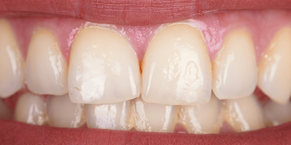 Clínica dental en Puerta de Toledo