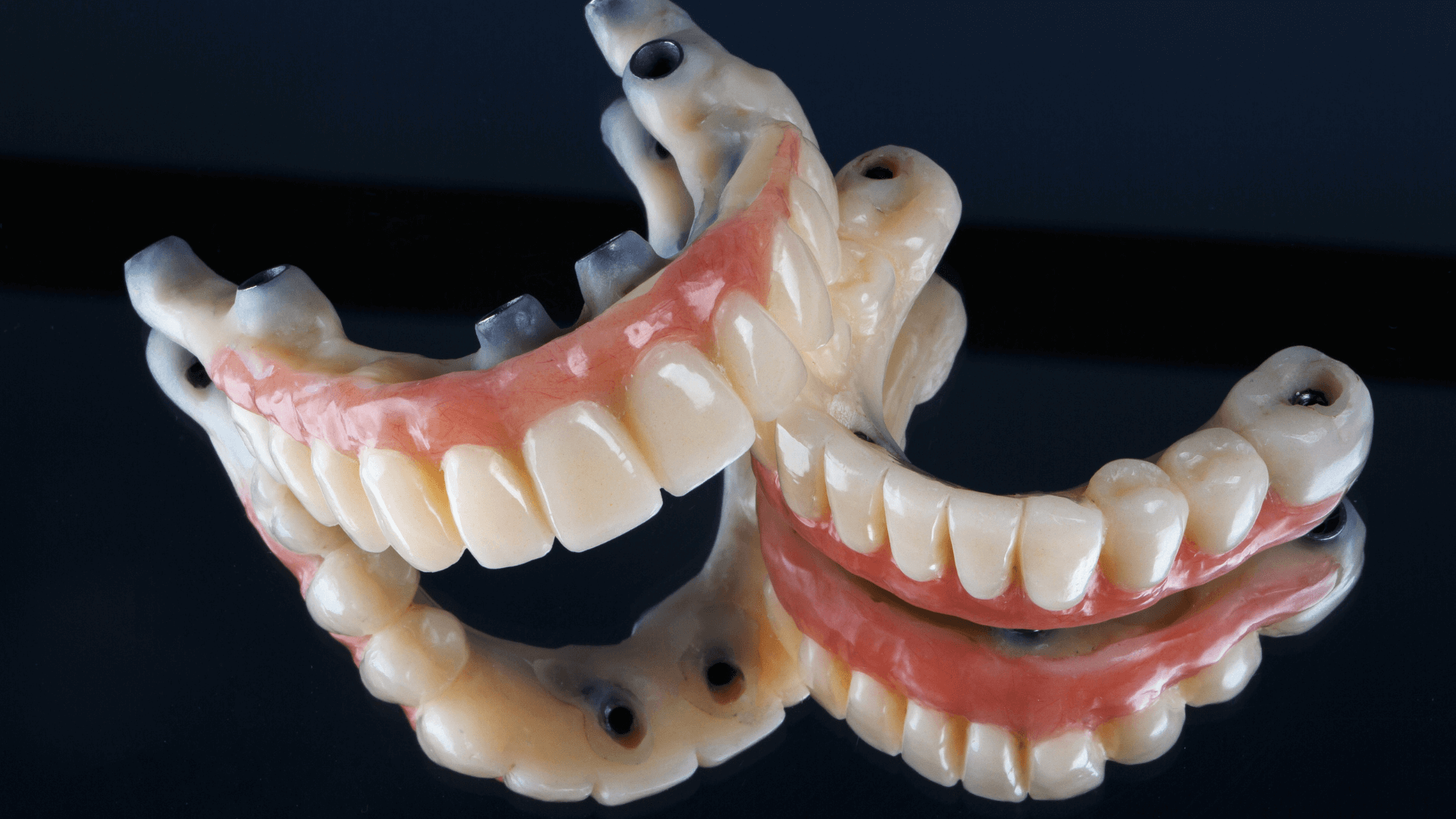 2 (8) All-on-six BEJA dental