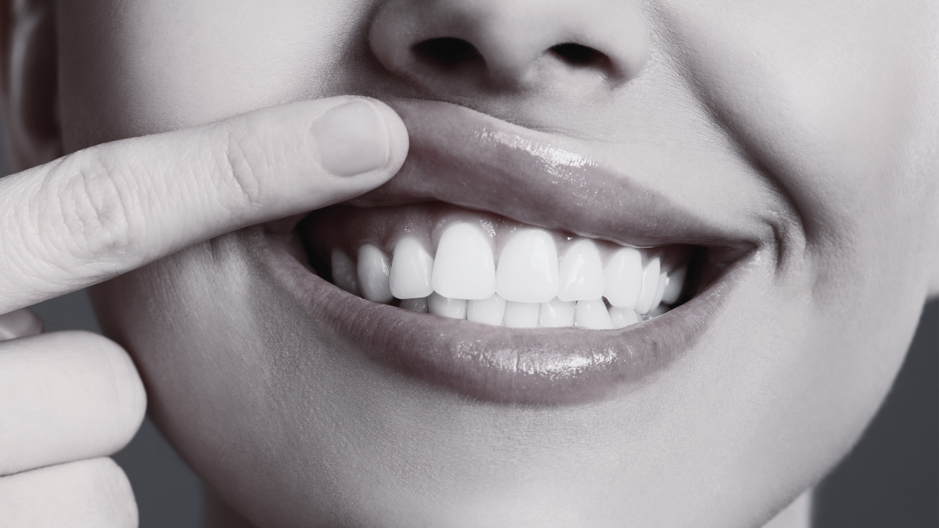 BEJA dental carillas dentales