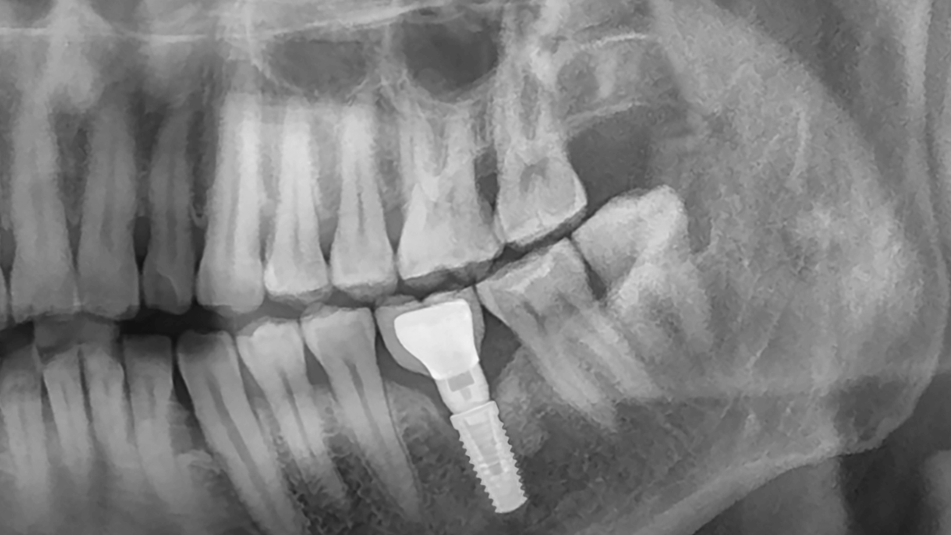Fondo Header BEJA dental Implantes