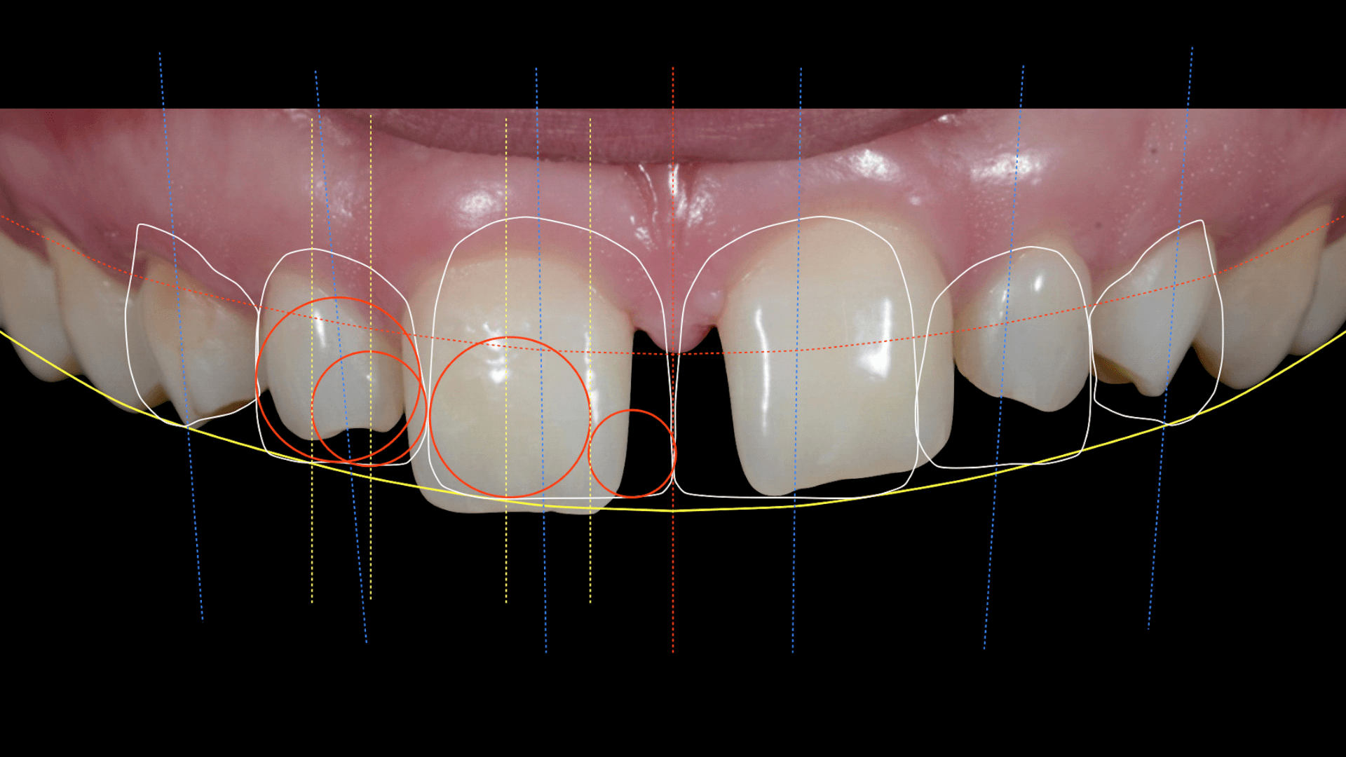 BEJA dental Diseño de sonrisa BEJA dental Diseño de sonrisa