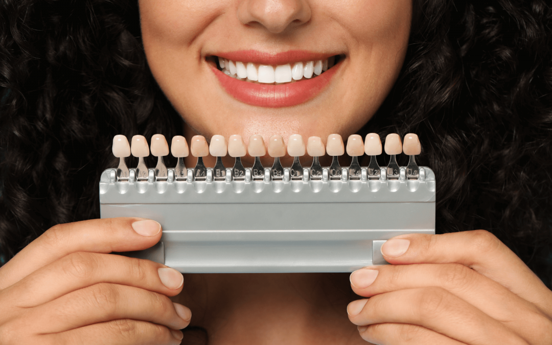 ¿Por qué aparecen manchas en los dientes?