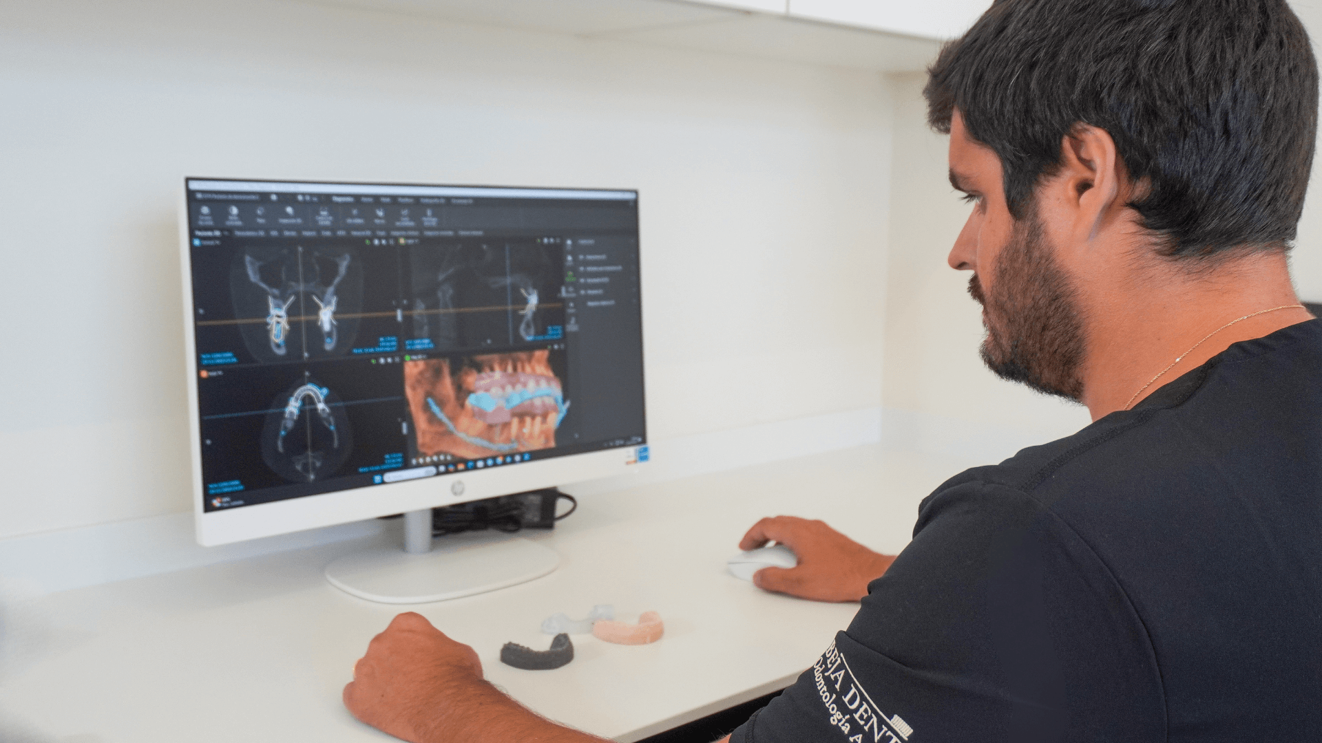 implantes dentales lanzarote Implantes dentales en Lanzarote