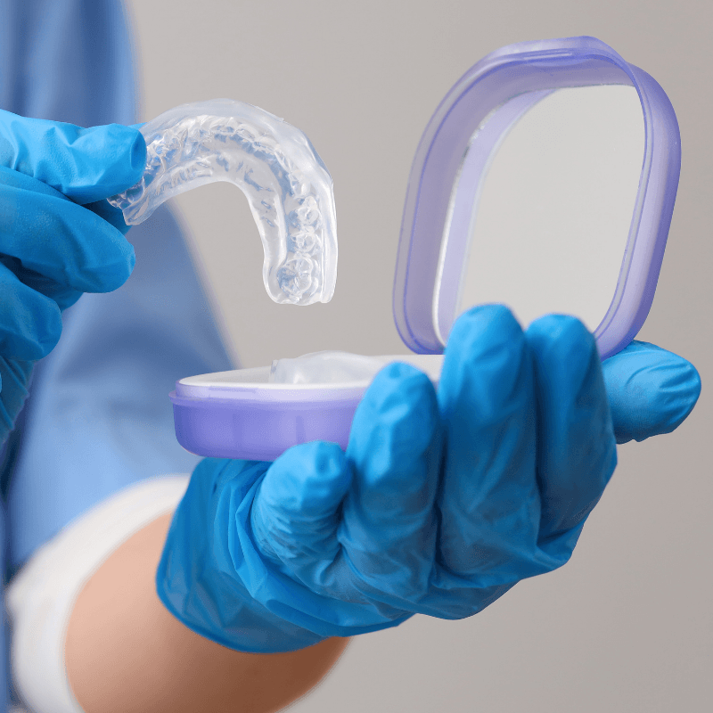 Manos con guantes azules de nitrilo colocando una férula de descarga dental rígida y transparente en su estuche de plástico, diseñada para el tratamiento del bruxismo nocturno.