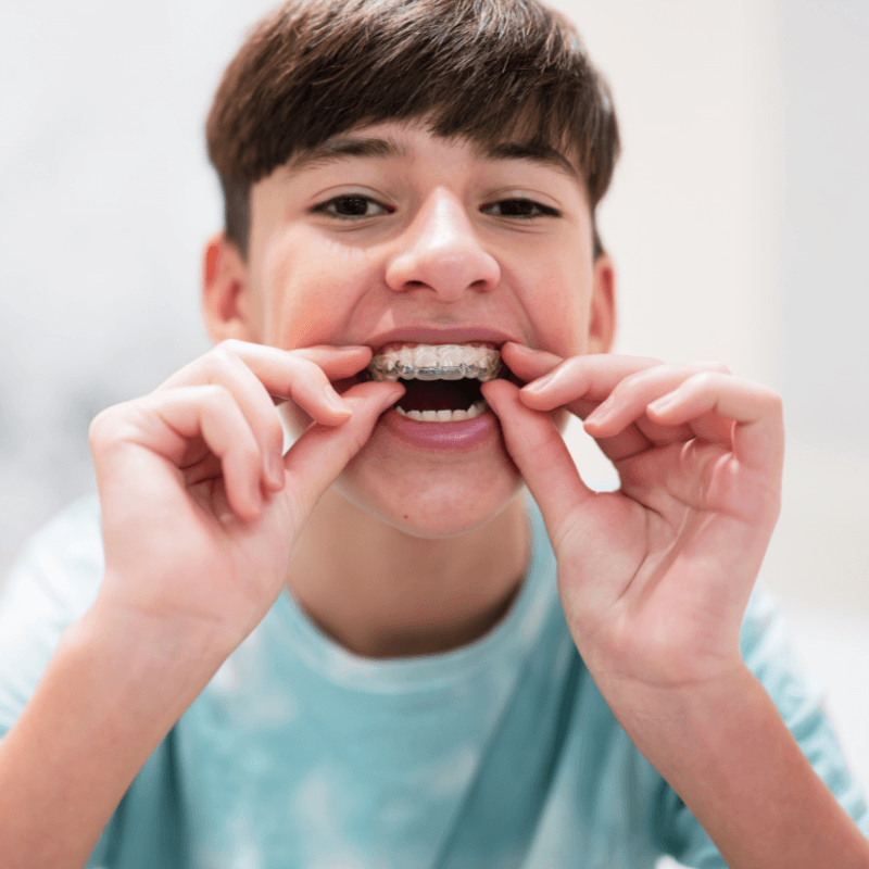Close-up de un niño sonriente de Costa Teguise poniéndose un alineador dental transparente con ambas manos. Ilustra que la ortodoncia invisible es apta para todas las edades, incluyendo adolescentes, en Lanzarote.