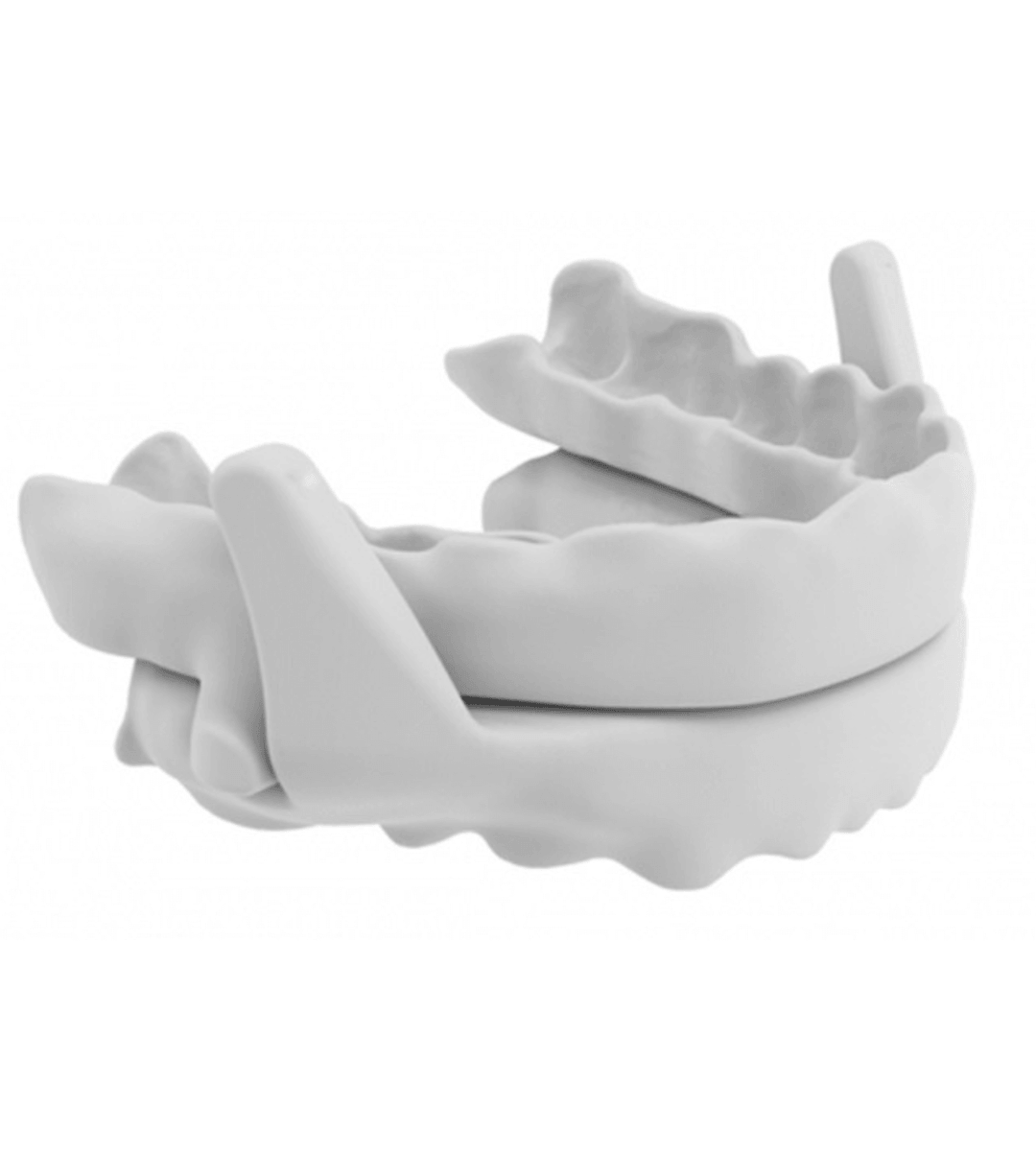 Dispositivo de avance mandibular personalizado para el tratamiento dental de ronquidos y apnea del sueño.