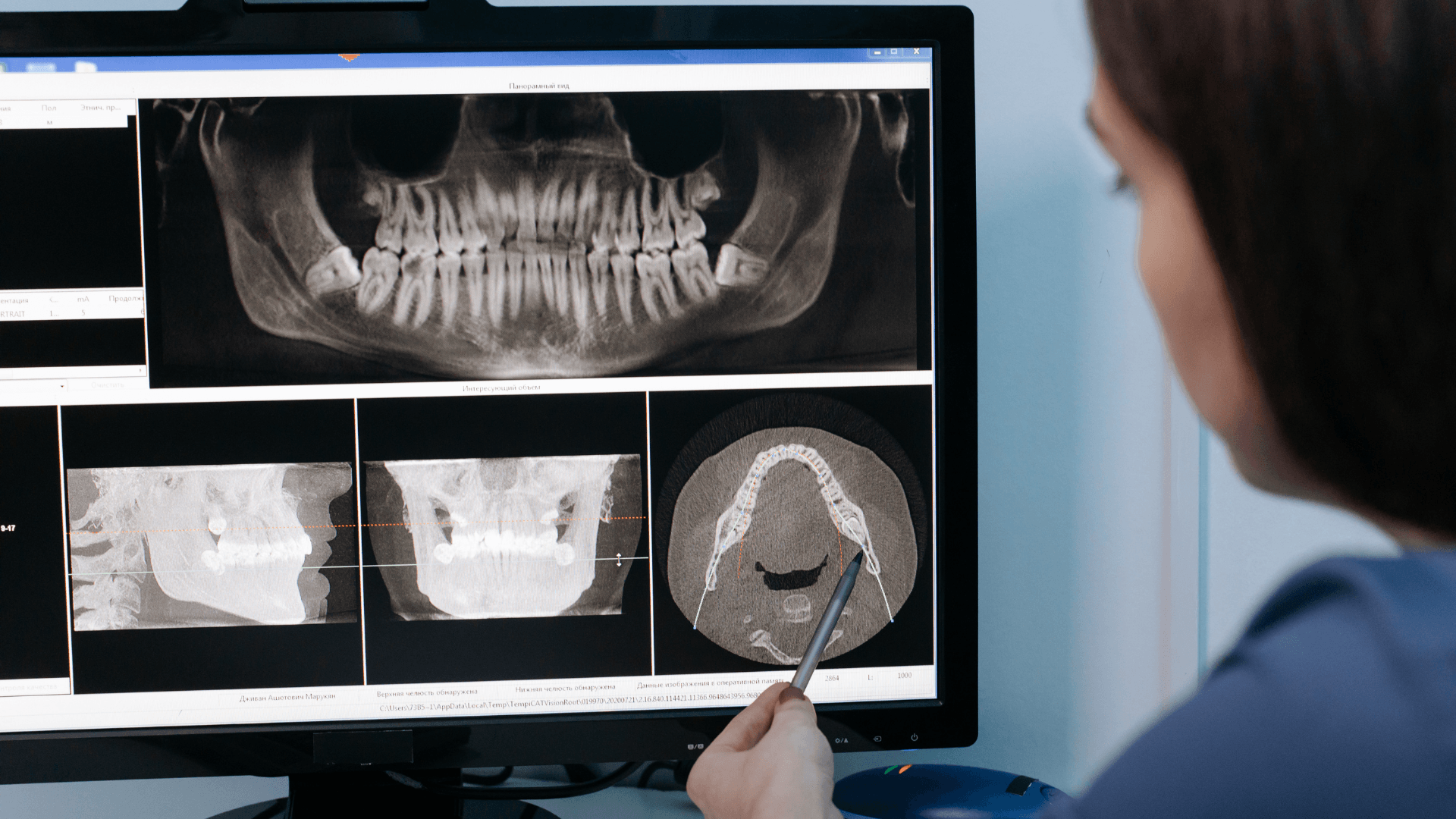 Doctor planificando una cirugía guiada sobre implantes dentales mediante radiografía digital en BEJA Dental.